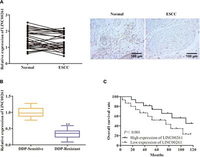 LINC00261 Suppresses Cisplatin Resistance of Esophageal Squamous Cell Carcinoma Through miR-545-3p/MT1M Axis